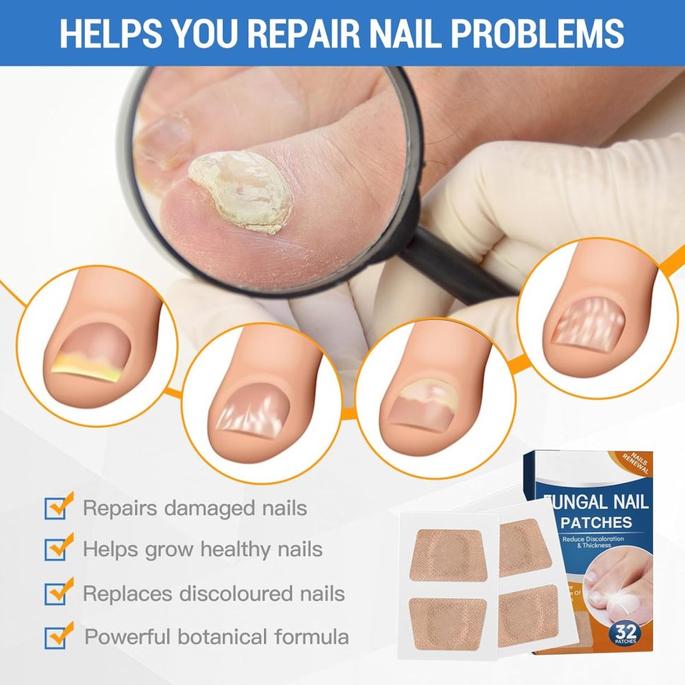 ✅Tratamiento extrafuerte para hongos en las uñas de los pies: 21 parches de hidrogel nocturnos para reparar las uñas de los pies durante la noche.🏥