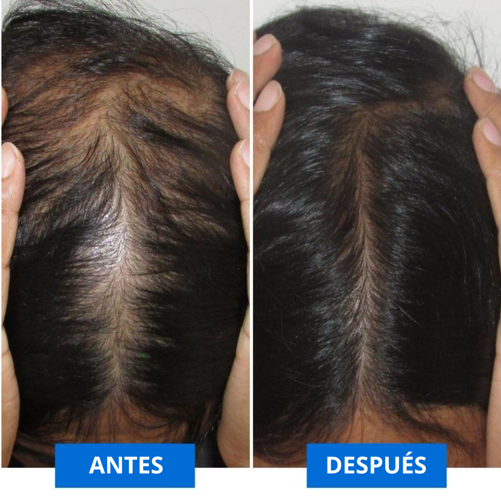 Capilzen – Tu Ritual de Belleza para Revivir tu Melena