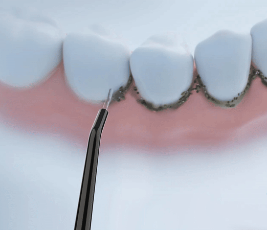 IRRIGADOR BUCAL RECARGABLE