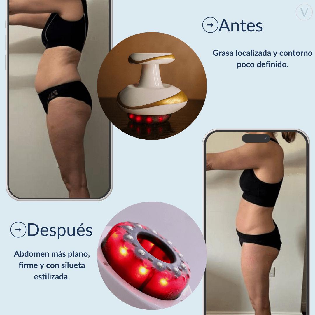 Vacuvia® SculptGlow™ - Piel más Firme y Tonificada - Vacuvia