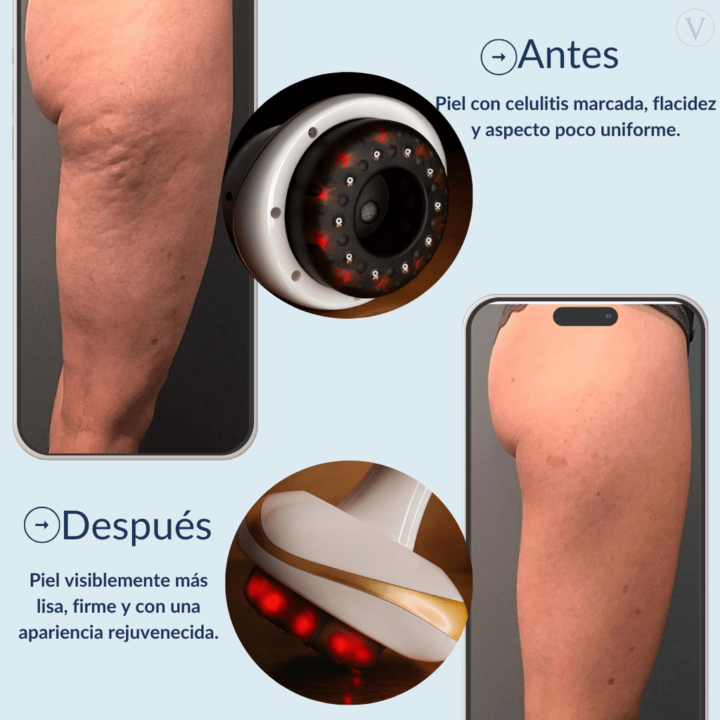 Vacuvia® SculptGlow™ - Piel más Firme y Tonificada - Vacuvia