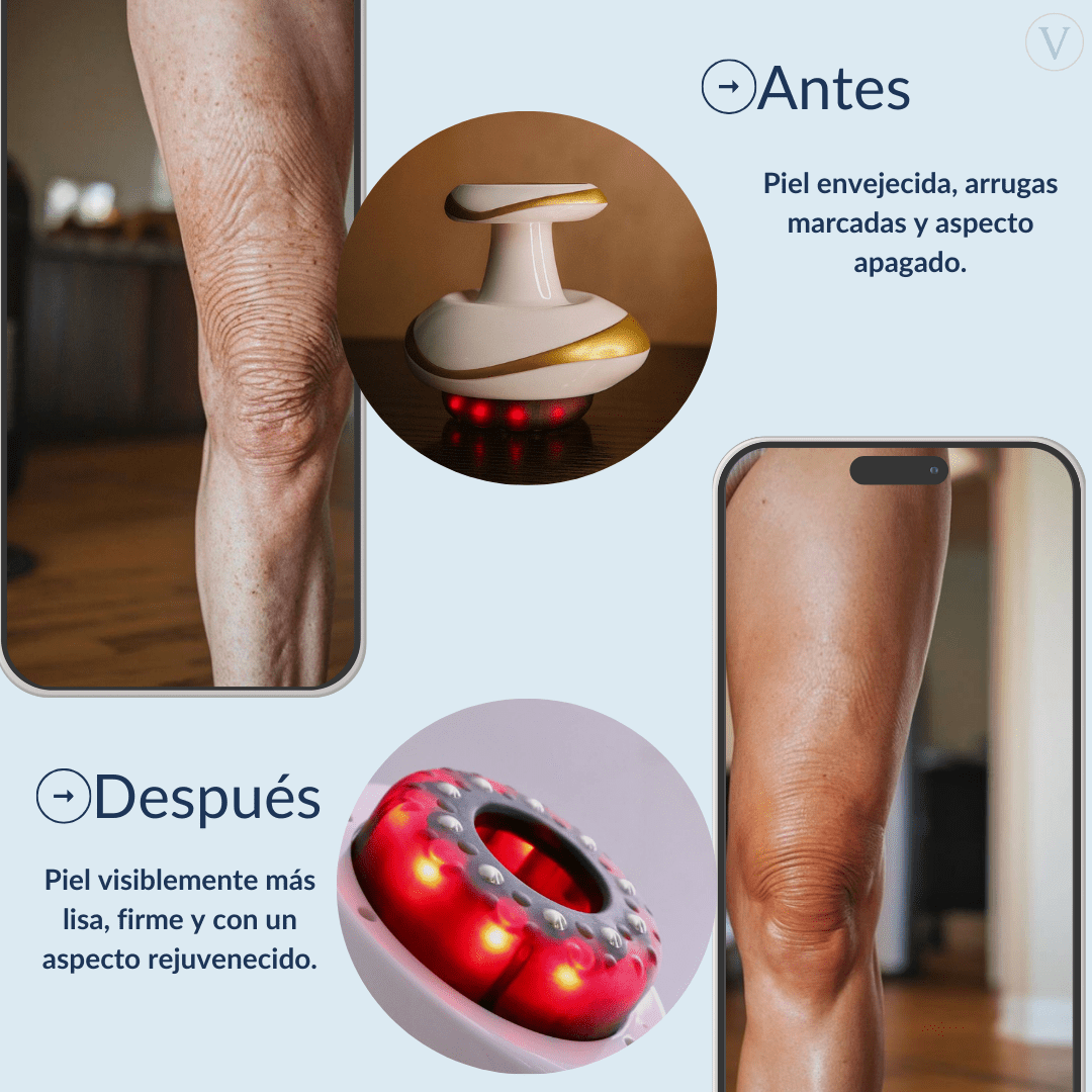 Vacuvia® SculptGlow™ - Piel más Firme y Tonificada - Vacuvia