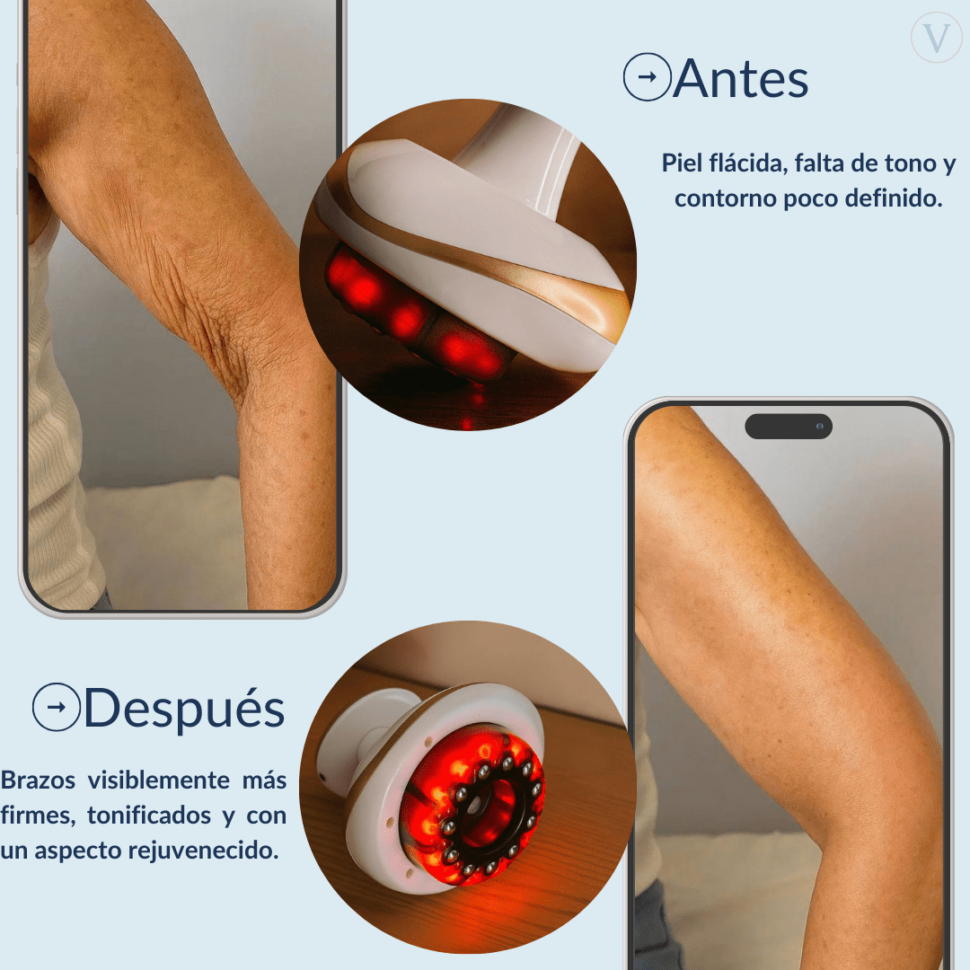 Vacuvia® SculptGlow™ - Piel más Firme y Tonificada - Vacuvia