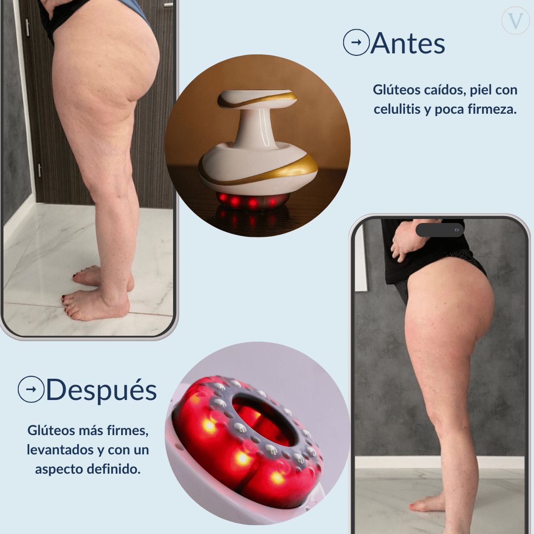 Vacuvia® SculptGlow™ - Piel más Firme y Tonificada - Vacuvia